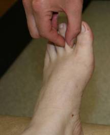 Figure 2b –  Negative Stemmer’s sign - left foot